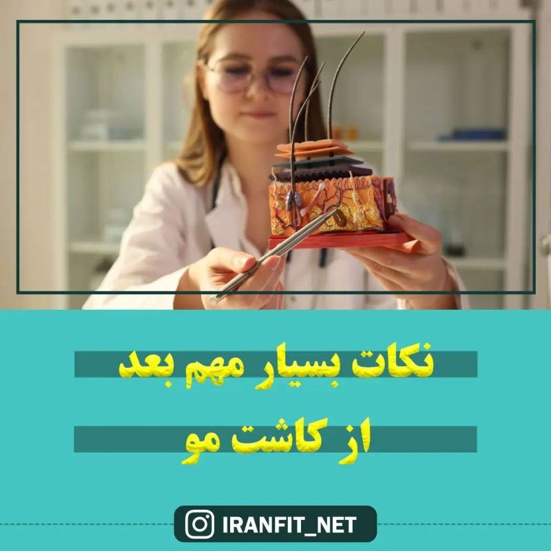 نکات بسیار مهم بعد از کاشت مو نکات بسیار مهم بعد از کاشت مو