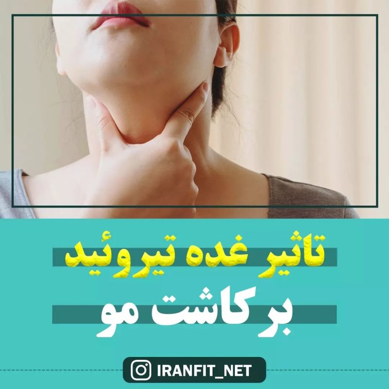 تاثیر غده تیرویید بر کاشت مو