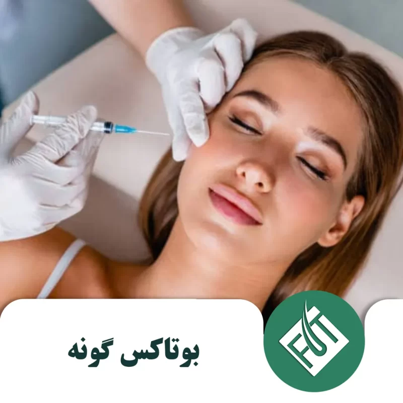 بوتاکس گونه