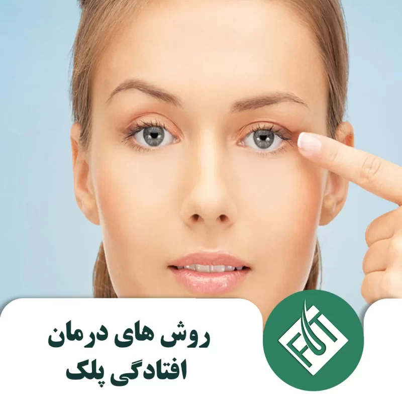 روش های درمان افتادگی پلک
