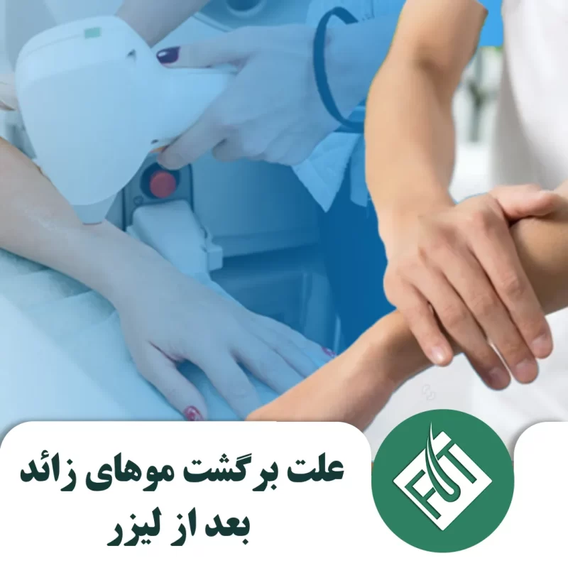 علت برگشت موهای زائد بعد از لیزر