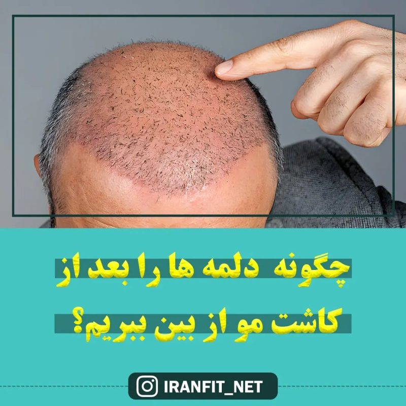 چگونه دلمه ها را از بین ببریم؟