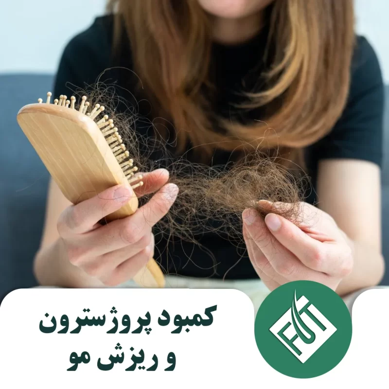 کمبود پروژسترون و ریزش مو