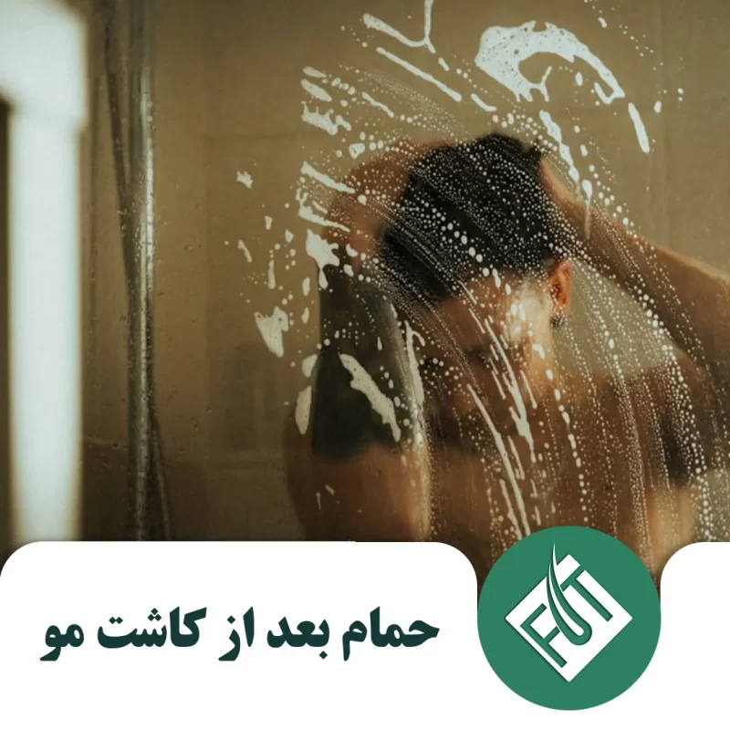 حمام بعد از کاشت مو