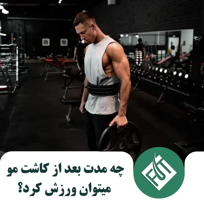 چه مدت بعد از کاشت مو میتوان ورزش کرد؟